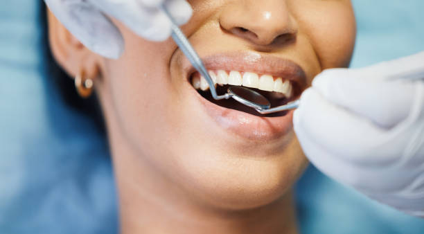 Best Emergency Dental Care for Abscessed Tooth in St Johns, MI