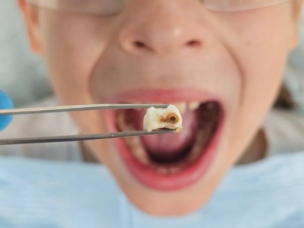 Best Emergency Dentist for Special Needs Patients in St Johns, MI
